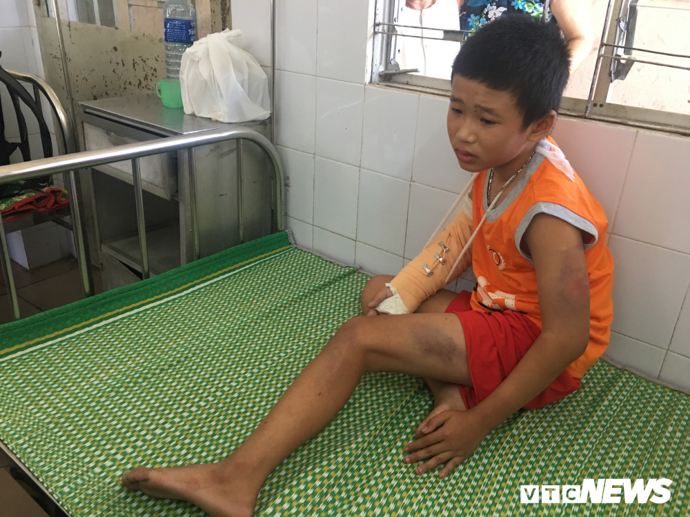 Cậu bé bán vé số bị cướp 1,2 triệu đồng, đánh đập dã man-1