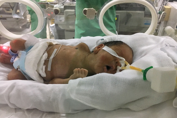 55 ngày hồi sinh diệu kỳ của 2 mẹ con Bình An-10