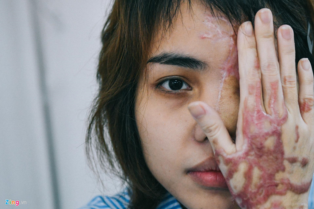 Cựu thiếu úy công an tạt axit vợ sắp cưới hầu tòa sáng nay-2