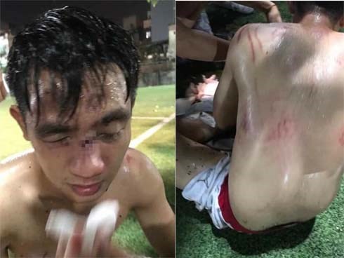 Tranh chấp khi đá bóng, 15 cầu thủ lao vào đánh đối phương nhập viện
