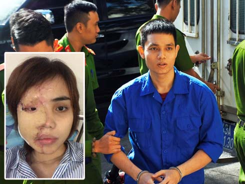 Vụ cựu Thiếu úy tạt a-xit vợ sắp cưới: Con tôi bị thân tàn ma dại mà nó bị 6 năm tù là không chấp nhận được”-3