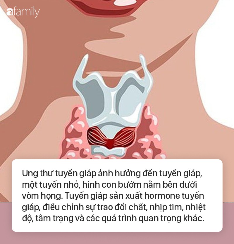 Nếu lưỡi của con bạn có dấu hiệu tương tự như em bé này, cẩn thận với bệnh ung thư tuyến giáp!-2