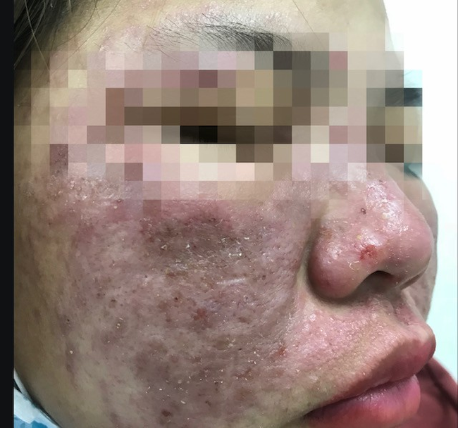 Lên đời nhan sắc: Điểm mặt nghìn lẻ một những tai biến-1