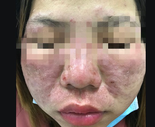 Lên đời nhan sắc: Điểm mặt nghìn lẻ một những tai biến-2