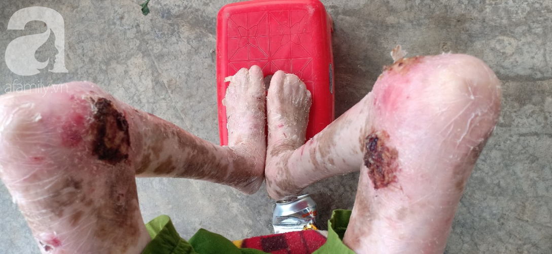 Tâm sự đau đớn của người rắn” 17 tuổi: Em còn sống ngày nào thì cha mẹ còn khổ thêm”-4