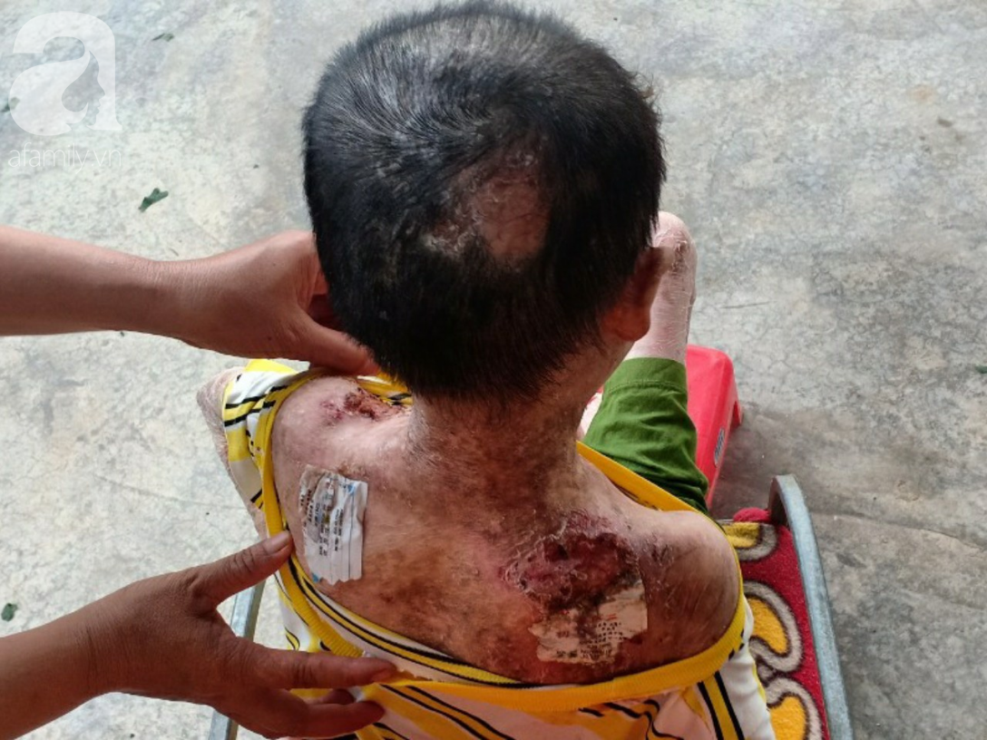 Tâm sự đau đớn của người rắn” 17 tuổi: Em còn sống ngày nào thì cha mẹ còn khổ thêm”-7