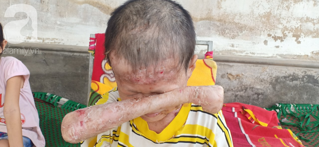 Tâm sự đau đớn của người rắn” 17 tuổi: Em còn sống ngày nào thì cha mẹ còn khổ thêm”-10