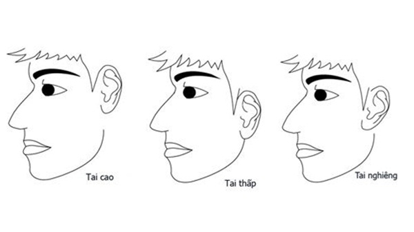 Xem tướng tai biết ngay ai giàu sang phú quý, ai có cuộc đời long đong, lận đận-1