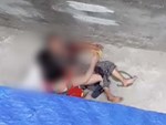Vụ cụ bà bị chó cắn kinh hoàng ở Hà Nội: Chủ nhân của con chó là cháu ngoại của nạn nhân-8