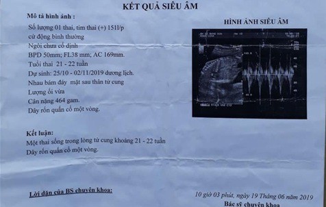Bé gái 14 tuổi ở Bình Định bị xâm hại, mang thai 6 tháng-1