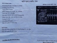 Bé gái 14 tuổi ở Bình Định bị xâm hại, mang thai 6 tháng
