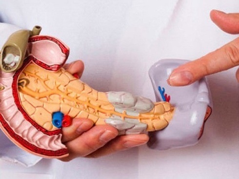 Bác sĩ bệnh viện Ung bướu chỉ ra những quan niệm sai lầm đẩy bệnh nhân ung thư nhanh tới cửa tử, nên ngừng tin ngay lập tức-14