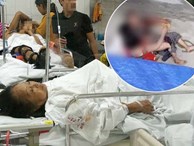 Cụ bà bị chó dữ tấn công ở Hà Nội phải khâu 30 mũi, kể lại giây phút ám ảnh khi đối mặt với tử thần