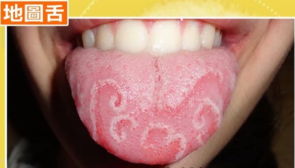 Bạn trai rùng mình” vội từ chối hôn ngay khi mở miệng, cô gái đi khám mới biết lý do-2