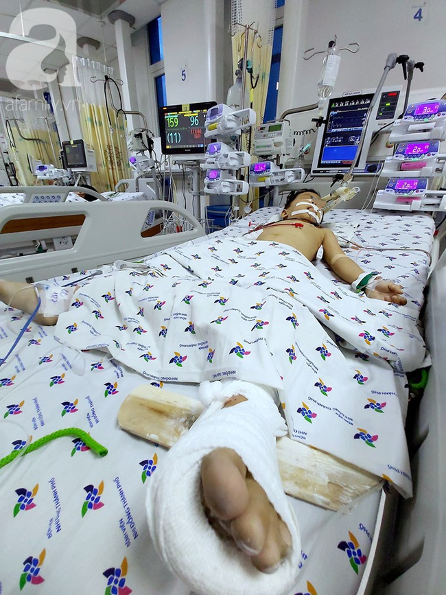 Mẹ bận làm việc nhà, bé trai 5 tuổi ra lan can chơi thì rớt từ tầng 12 xuống đất nguy kịch-3