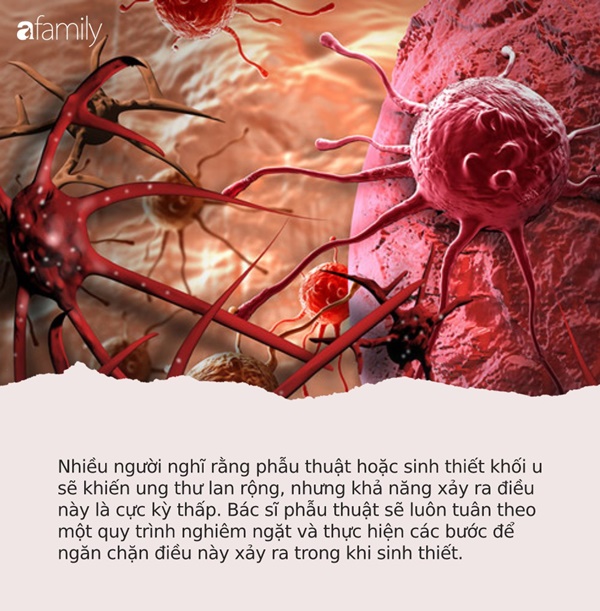 Bác sĩ bệnh viện Ung bướu chỉ ra những quan niệm sai lầm đẩy bệnh nhân ung thư nhanh tới cửa tử, nên ngừng tin ngay lập tức-6