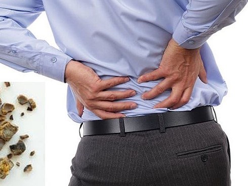 Có thể hỏng thận vĩnh viễn vì lý do không thể ngờ này