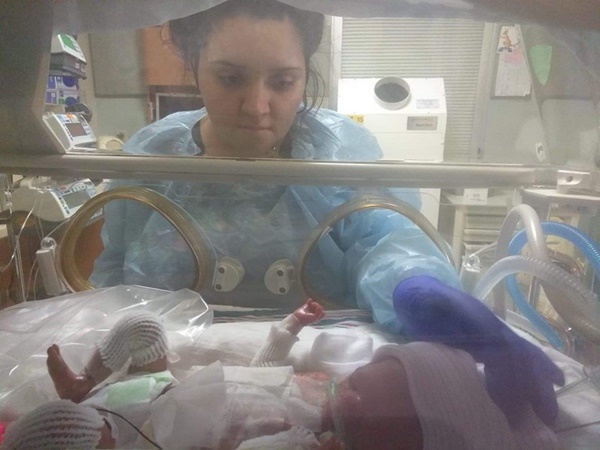 Bé trai bị bệnh viện trả về vì bẩm sinh không có da, 8 tháng sau điều kỳ diệu đã đến-1