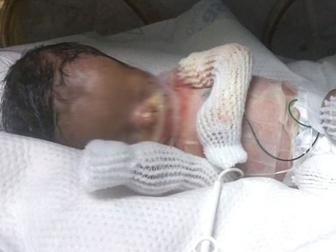 Mẹ thay bỉm, con khóc thét, ngỡ ngàng phát hiện đây là dấu hiệu bệnh gây tàn tật suốt đời-6