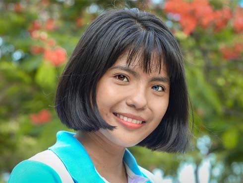 Trúng đại học, nữ sinh có đôi mắt 2 màu chọn cao đẳng