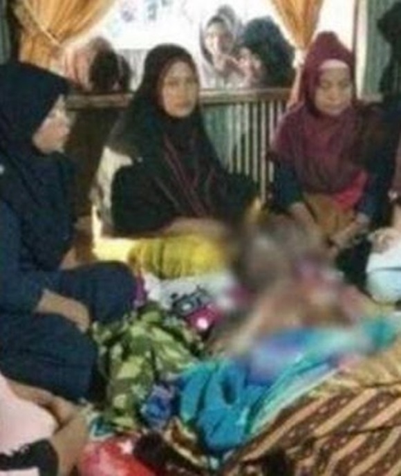 Vợ dội nguyên xô nước sôi lên chồng sau khi phát hiện anh ta bí mật kết hôn với hàng xóm-1