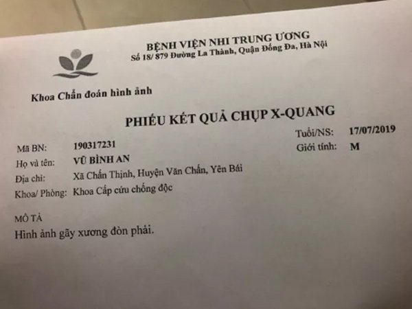 Chưa kịp vui mừng vì con chào đời, sản phụ choáng váng nhận tin con bị gãy xương đòn-2