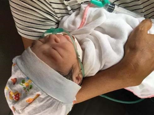 Chưa kịp vui mừng vì con chào đời, sản phụ choáng váng nhận tin con bị gãy xương đòn