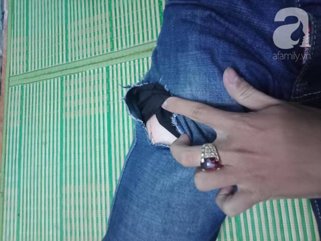 Nam sinh viên bị 4 kẻ lạ mặt tấn công, rạch đùi cướp tài sản ngay trước hẻm nhà trọ-1