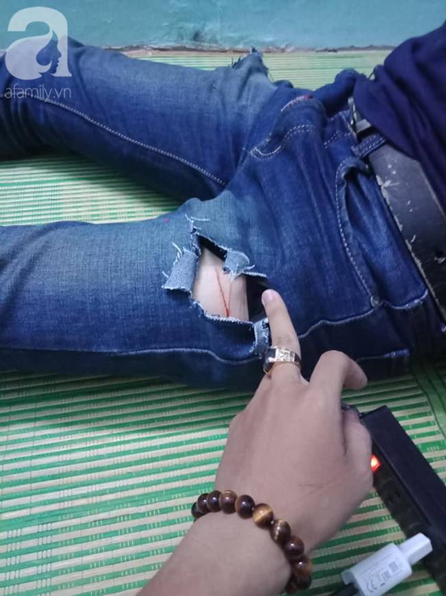 Nam sinh viên bị 4 kẻ lạ mặt tấn công, rạch đùi cướp tài sản ngay trước hẻm nhà trọ-3