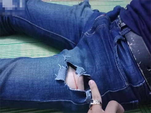 Nam sinh viên bị 4 kẻ lạ mặt tấn công, rạch đùi cướp tài sản ngay trước hẻm nhà trọ