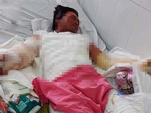 Lời nói dối nghẹn ngào của người mẹ chăm bố bị điện giật nặng: 