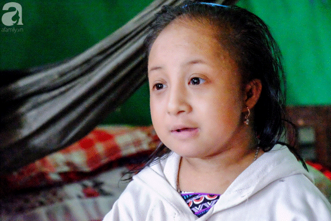 Cô bé tí hon 17 tuổi chỉ nặng 9kg và ước mơ: Em muốn làm họa sĩ để vẽ mọi thứ đẹp hơn-11