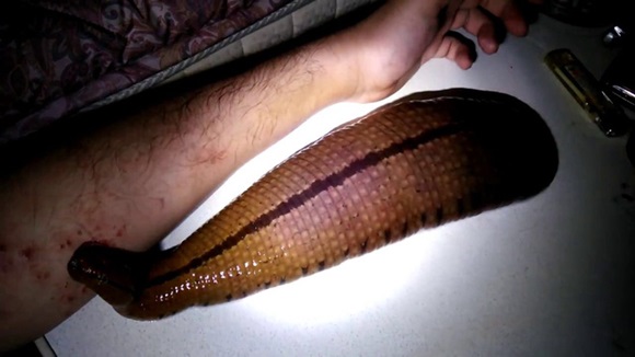 Có những người nuôi đỉa như thú cưng, cho chúng ăn bằng máu của mình-3