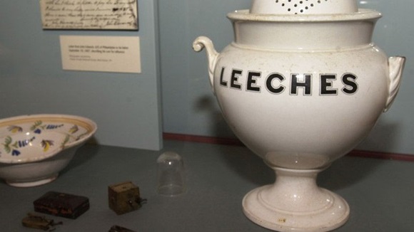 Có những người nuôi đỉa như thú cưng, cho chúng ăn bằng máu của mình-4