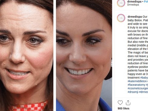 Cung điện hoàng gia lên tiếng chính thức trước nghi vấn Công nương Kate can thiệp thẩm mỹ với khuôn mặt bất thường gây tranh cãi