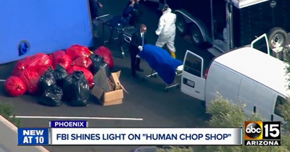 FBI tiết lộ những phát hiện kinh hoàng bên trong cơ sở bán bộ phận cơ thể người núp bóng trung tâm hiến tạng-1