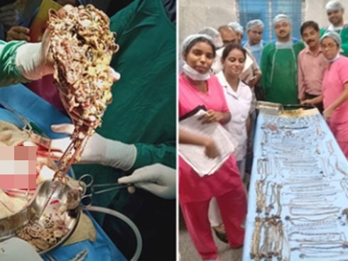 Các bác sĩ “giật mình” khi phát hiện gần 1,6kg trang sức cùng 1,5 tỷ đồng nằm gọn trong dạ dày người phụ nữ bởi một hội chứng bí ẩn