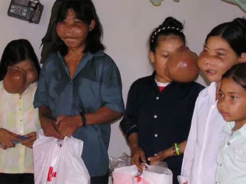 Năm chị em có khuôn mặt