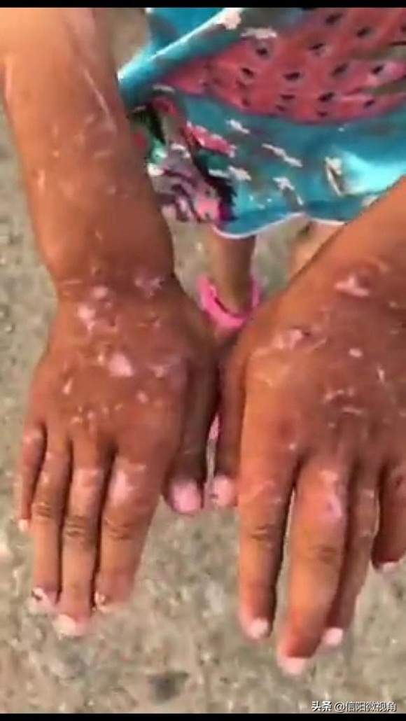 Cháu không nghe lời bị bà nội bạo hành, khi nhìn thấy vết thương trên cơ thể ai cũng phẫn nộ muốn bỏ tù người bà ngay lập tức-2