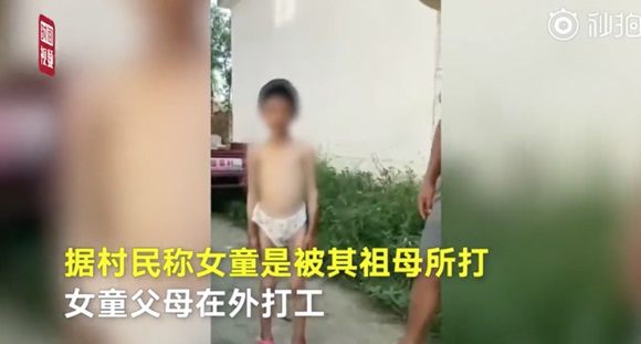 Cháu không nghe lời bị bà nội bạo hành, khi nhìn thấy vết thương trên cơ thể ai cũng phẫn nộ muốn bỏ tù người bà ngay lập tức-5