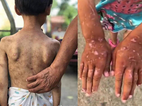 Bé 2 tuổi có thể phải sống thực vật vì nghi bị mẹ kế bạo hành-3