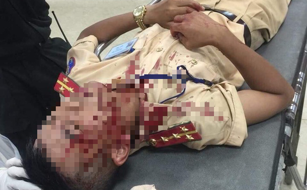 Lời khai của kẻ cầm đá tấn công đại úy CSGT đến bất tỉnh: Do bực tức khi bị lập biên bản-1