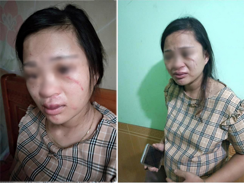 Xôn xao clip nam thanh niên lăn lộn quằn quại giữa quán nước ở Hà Nội, liên tục la hét gọi bố mẹ ơi-3