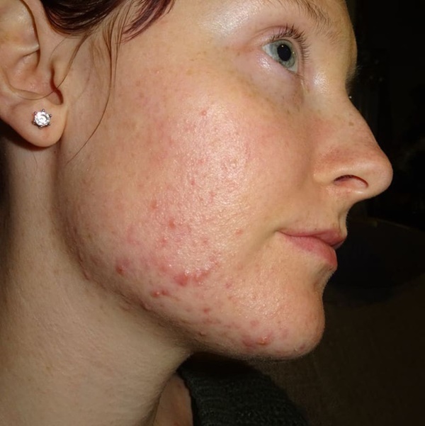 Đây là loạt dấu hiệu tố cáo cơ thể con gái đang có bệnh, cần chú ý để chữa trị ngay-2