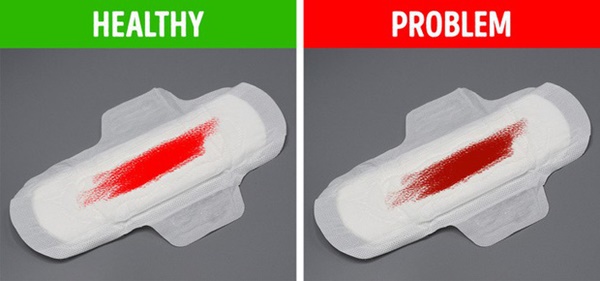 Đây là loạt dấu hiệu tố cáo cơ thể con gái đang có bệnh, cần chú ý để chữa trị ngay-4