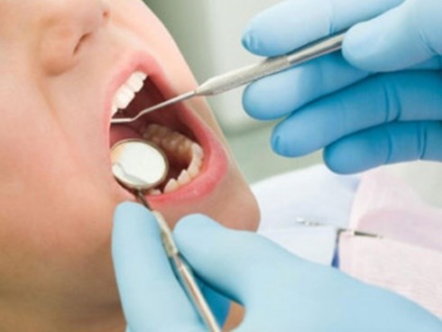 Mất mạng vì nhổ răng, chuyên gia cảnh báo 4 thời điểm tuyệt đối không nhổ răng khôn
