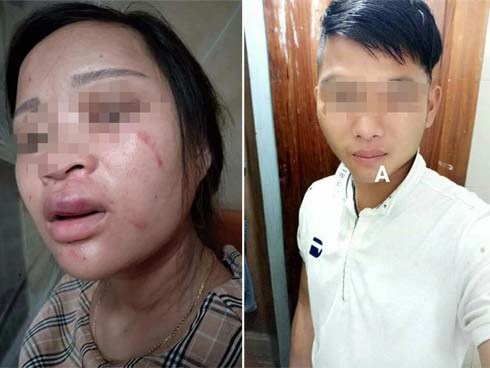 Mẹ thai phụ 8 tháng bị chồng đánh dã man vì mua giày 135 ngàn: 