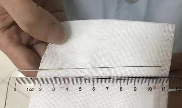 Học hỏi cổ nhân Trung Hoa, cậu bé 12 tuổi tự đâm kim châm cứu vào của quý để tỉnh ngủ khi làm bài tập về nhà-5