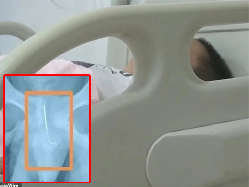 Câu chuyện về ‘Ghost boy’ - cậu bé ma mắc kẹt trong chính cơ thể mình suốt 12 năm trời cùng hành trình miệt mài tìm lại sự sống-9