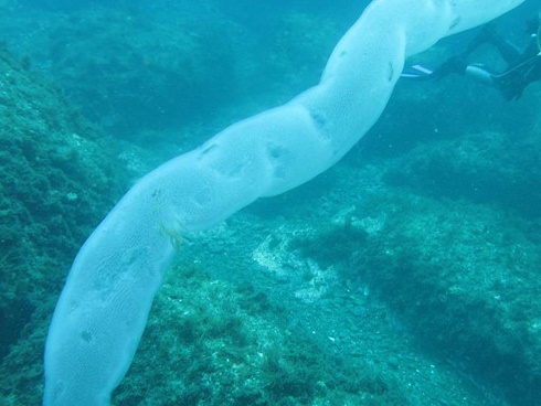 Nam thanh niên đi chân trần trên đất, về nhà tiêu chảy ra máu khoảng 30 lần/ngày-4